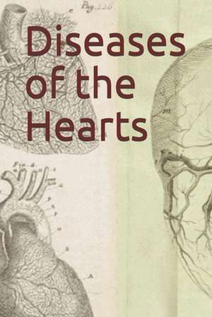 Diseases of the Hearts de Ibn Taymiyyah