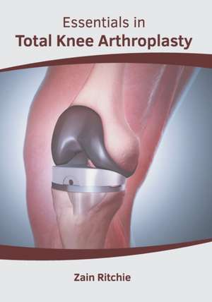 Essentials in Total Knee Arthroplasty de Zain Ritchie