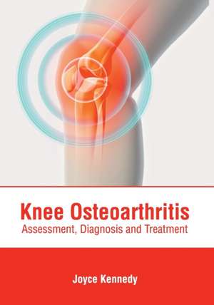 Knee Osteoarthritis: Assessment, Diagnosis and Treatment de Joyce Kennedy