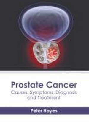 Prostate Cancer: Causes, Symptoms, Diagnosis and Treatment de Peter Hayes