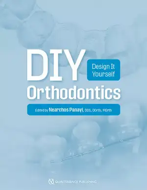 DIY Orthodontics: Design It Yourself de Nearchos C. Panayi 