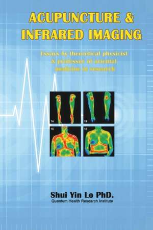 Acupuncture and Infrared Imaging de Shui Yin Lo