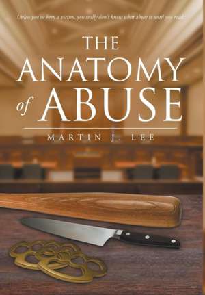 The Anatomy of Abuse de Martin J Lee