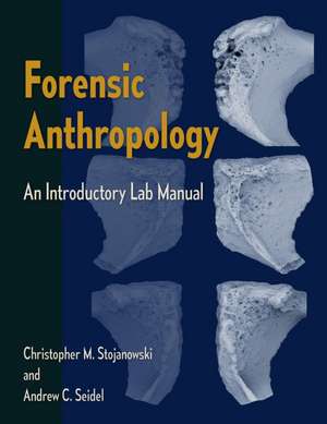 FORENSIC ANTHROPOLOGY de Andrew C. Seidel