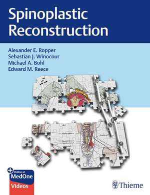 Spinoplastic Reconstruction de Alexander Ropper