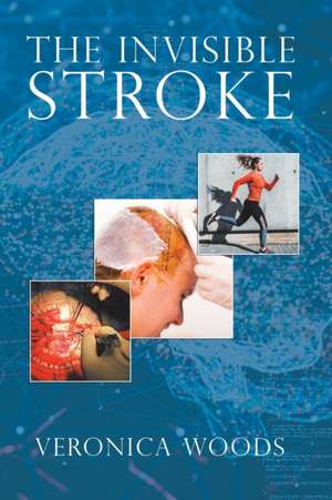 The Invisible Stroke de Veronica Woods