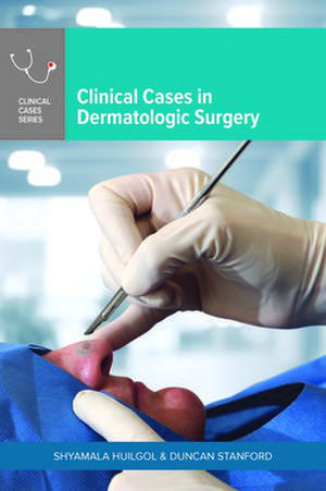 Clinical Cases in Dermatologic Surgery de Shyamala Huilgol