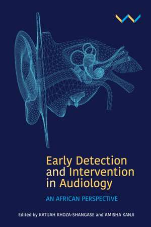 Early Detection and Intervention in Audiology de Katijah Khoza-Shangase