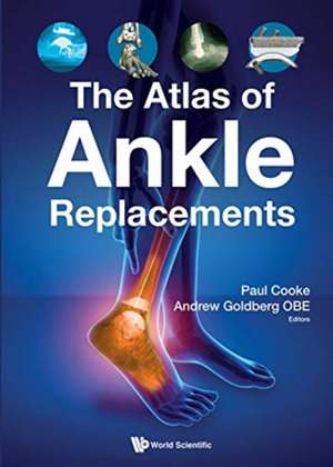 The Atlas of Ankle Replacements de Andrew J Goldberg Obe