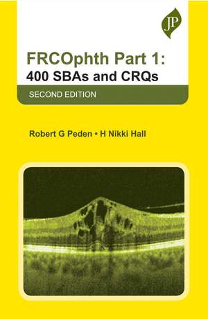 FRCOphth Part 1: 400 SBAs and CRQs de Robert G Peden