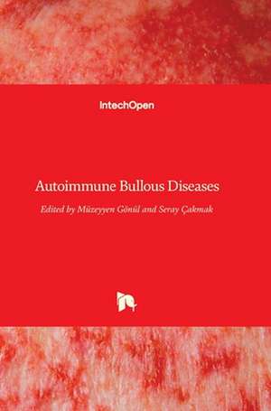 Autoimmune Bullous Diseases de Müzeyyen Gönül