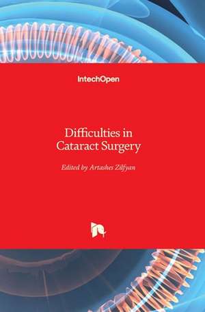 Difficulties in Cataract Surgery de Artashes Zilfyan