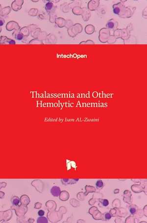 Thalassemia and Other Hemolytic Anemias de Isam Jaber Al-Zwaini