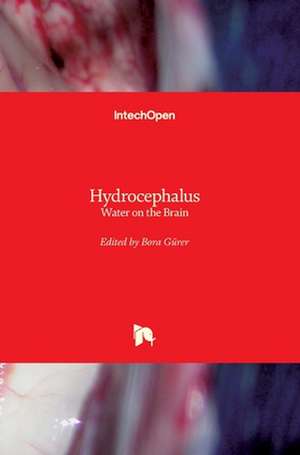 Hydrocephalus de Bora Gürer