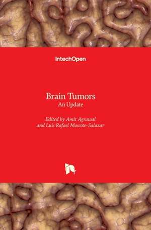 Brain Tumors de Amit Agrawal