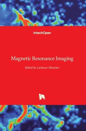 Magnetic Resonance Imaging de Lachezar Manchev