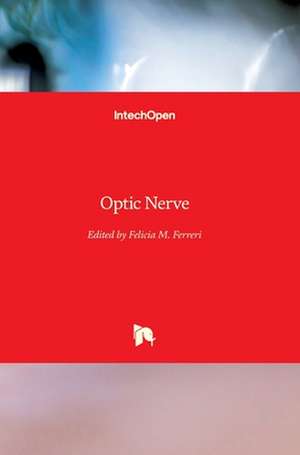 Optic Nerve de Felicia M. Ferreri