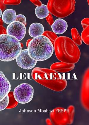 Leukaemia de Johnson Mbabazi