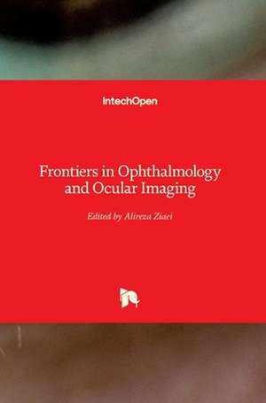 Frontiers in Ophthalmology and Ocular Imaging de Alireza Ziaei