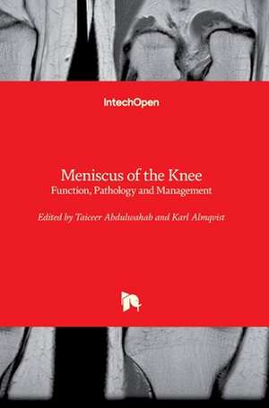 Meniscus of the Knee de Taiceer Abdulwahab