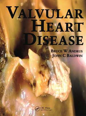 Valvular Heart Disease de Bruce Andrus