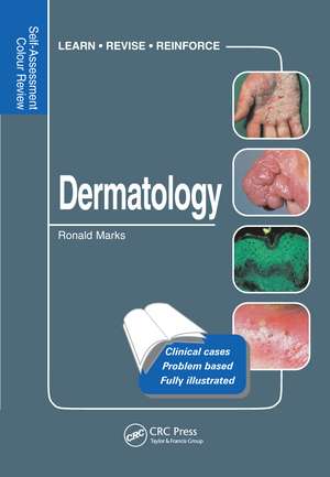 Dermatology: Self-Assessment Colour Review de Ronald Marks