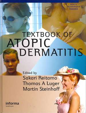 Textbook of Atopic Dermatitis de Sakari Reitamo