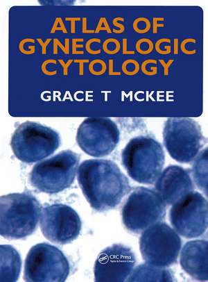 Atlas of Gynecologic Cytology de Grace T. McKee