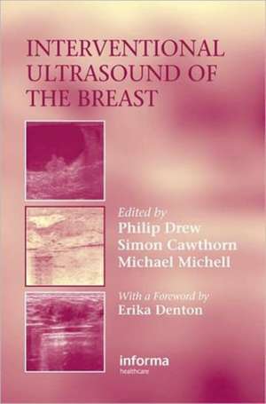 Interventional Ultrasound of the Breast de Philip Drew