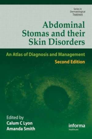 Abdominal Stomas and Their Skin Disorders