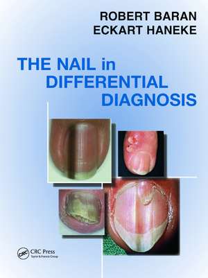 Nail in Differential Diagnosis de Robert Baran