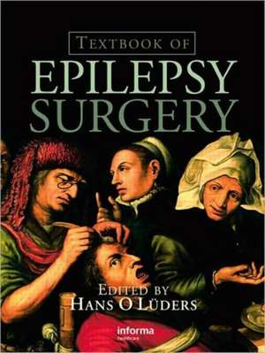 Textbook of Epilepsy Surgery de Hans O. Luders