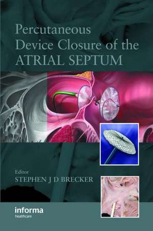 Percutaneous Device Closure of the Atrial Septum de Stephen Brecker