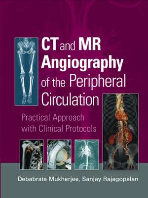 CT and MR Angiography of the Peripheral Circulation: Practical Approach with Clinical Protocols de Debabrata Mukherjee