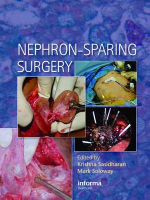 Nephron-Sparing Surgery de Krishna Sasidharan