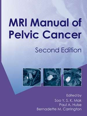 MRI Manual of Pelvic Cancer,Second Edition de Soo Mak