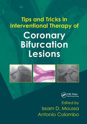 Tips and Tricks in Interventional Therapy of Coronary Bifurcation Lesions de Issam Moussa