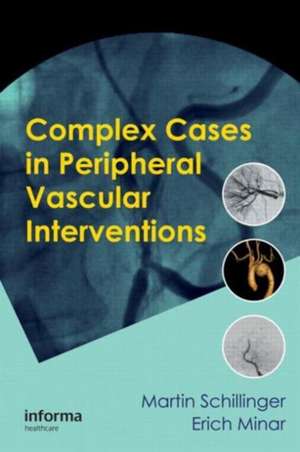 Complex Cases in Peripheral Vascular Interventions de Martin Schillinger