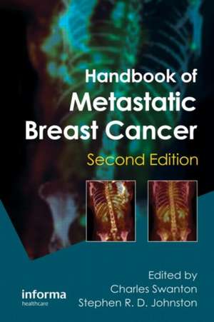 Handbook of Metastatic Breast Cancer de Charles Swanton