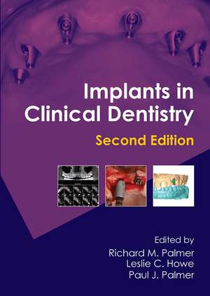 Implants in Clinical Dentistry de Richard M. Palmer