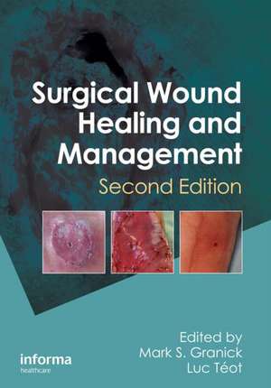 Surgical Wound Healing and Management de Mark S. Granick