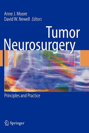 Tumor Neurosurgery: Principles and Practice de Anne J. Moore