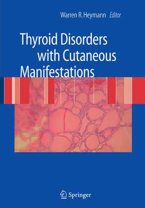 Thyroid Disorders with Cutaneous Manifestations de Warren R. Heymann