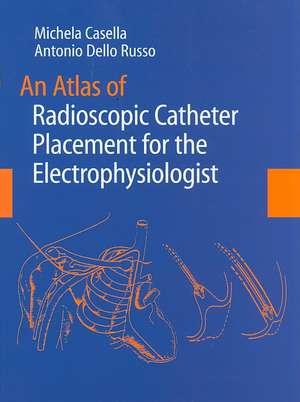 An Atlas of Radioscopic Catheter Placement for the Electrophysiologist de Michela Casella