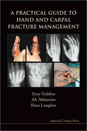 A Practical Guide to Hand and Carpal Fracture Management de Grey Giddins