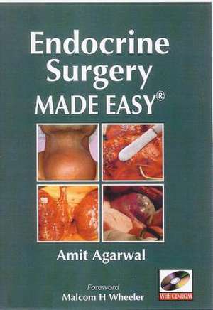 Endocrine Surgery Made Easy [With Mini CDROM] de Amit Agarwal