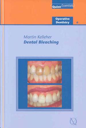 Dental Bleaching Operative Dentistry 6 de Quintessence (COR)