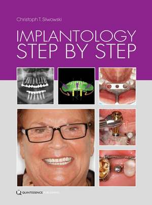 Implantology Step by Step de Christoph T. Sliwowski