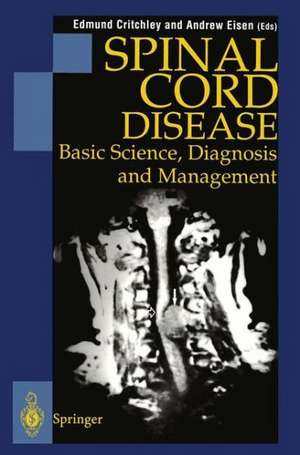 Spinal Cord Disease: Basic Science, Diagnosis and Management de Edmund Critchley