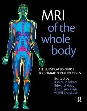 MRI of the Whole Body: An Illustrated Guide to Common Pathologies de Nikhil Bhuskute